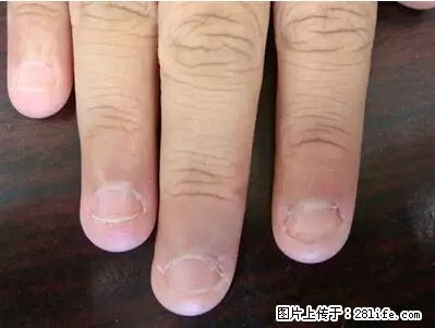 剪指甲、挖耳屎，这些日常小动作竟隐藏大危害！ - 周口生活资讯 - 周口28生活网 zk.28life.com